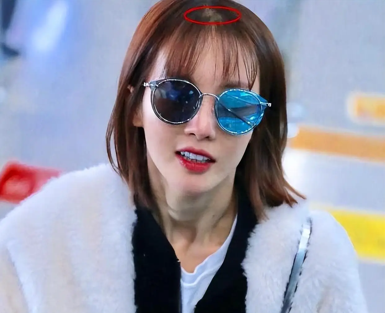 发量少的女明星有哪些_女明星脱发严重_杨幂赵丽颖金晨假发片